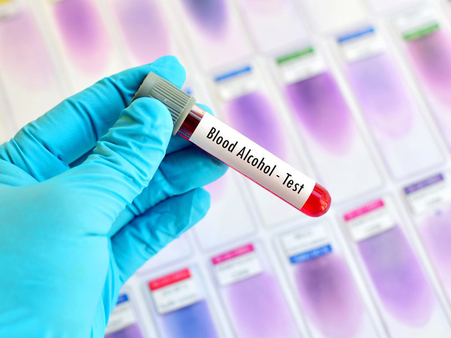 在抚州哪有亲子鉴定检验中心,抚州血缘检测收费多少